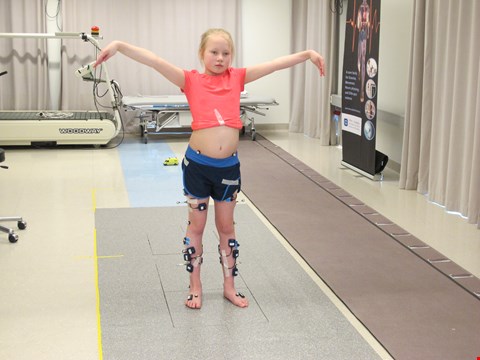KLAR FOR SISTE TEST: Sigrids ben er fulle av EMG-elektroder, markører og reflekskuler som skal måle aktivitet og spastisitet. Foto: HEIDI ØSTHUS ERIKSSEN